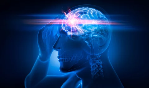 Illustration: Männerkopf mit Blitz im Gehirn; symbolisch für Kopfschmerz