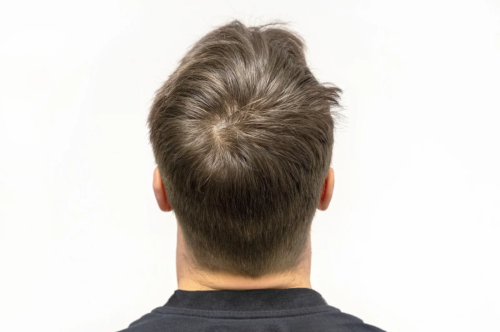 Hinterkopf von einem Mann mit braunen Haaren.
