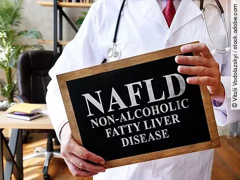 Arzt hält Schild mit der Aufschrift NAFLD - Non-alcoholic fatty liver disease