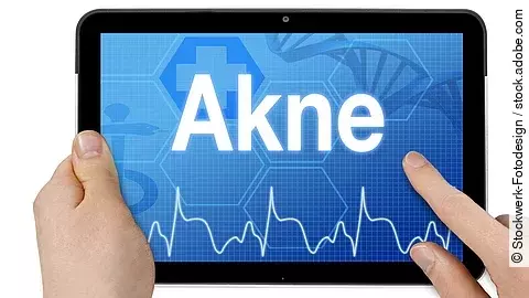 Tablet-Display mit dem Wort Akne auf blauem Screen