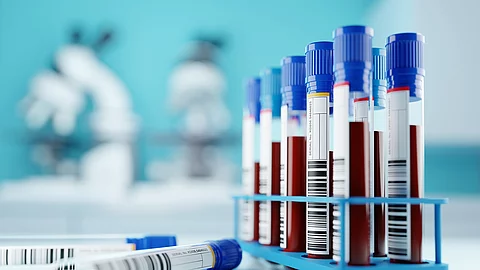 mit Blut gefüllte Monovetten im Ständer in einem Labor