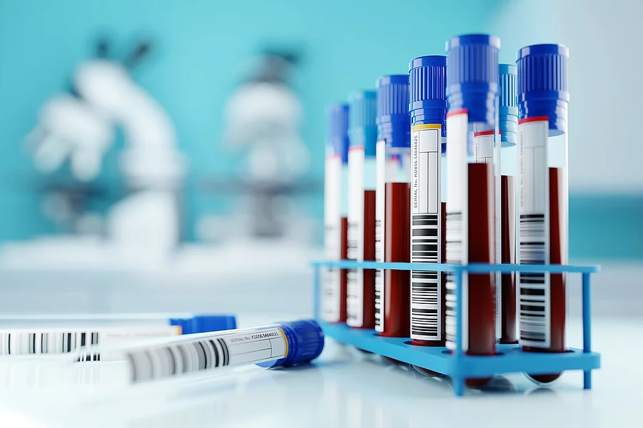 A Row of Human Blood Samples In A Medical Laboratory mit Blut gefüllte Monovetten im Ständer in einem Labor