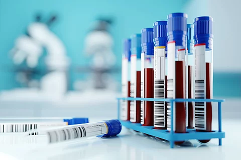 mit Blut gefüllte Monovetten im Ständer in einem Labor