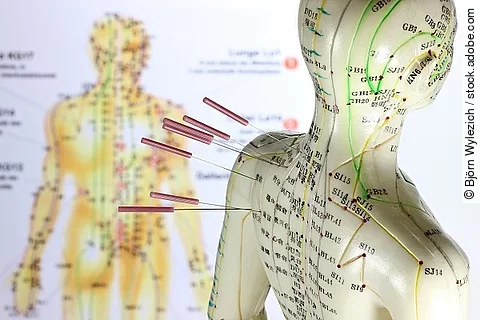 weibliches Akupunkturmodell mit Nadeln im Schulterbereich vor Lehrtafel