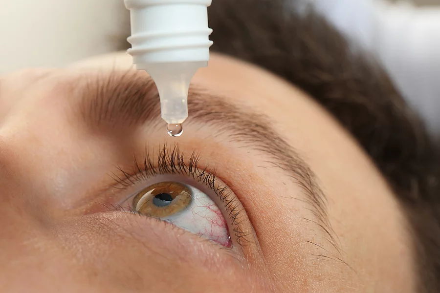 Mann tropft sich Augentropfen in die Augen