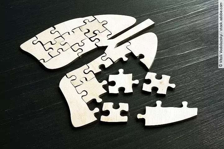 Puzzle in the lung form. Respiratory disease like a cancer conce Lunge, Puzzle, Lungenerkrankung