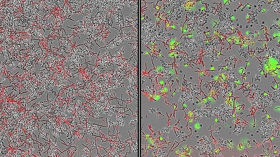 2 Mikroskopische Aufnahmen: links Co-Kulturen von S. cerivisiae mit C. albicans (rot). Rechts: Abgestorbene Immunzellen (grün) in Co-Kultur; deutlich verringerte Zahl von Candida-Zellen durch S.