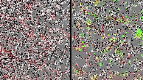 2 Mikroskopische Aufnahmen: links Co-Kulturen von S. cerivisiae mit C. albicans (rot). Rechts: Abgestorbene Immunzellen (grün) in Co-Kultur; deutlich verringerte Zahl von Candida-Zellen durch S.