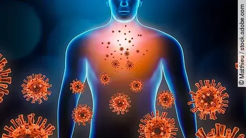 Illustration: Viral ausgelöste Pneumonie