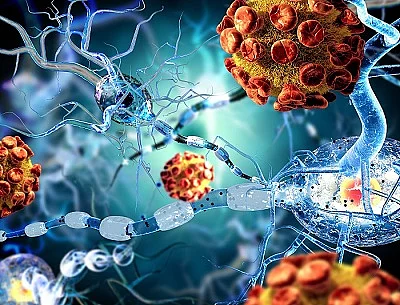3d illustration of nerve cells, concept for Neurological Disease Nervenzellen, Illustration