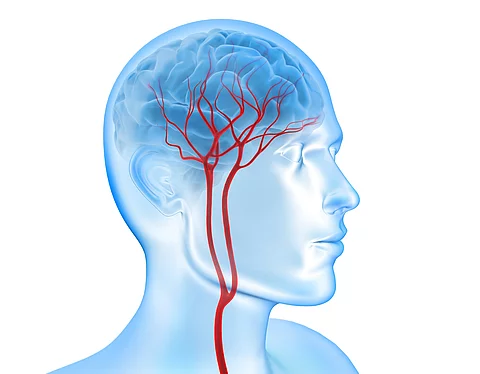 Eine Grafik zeigt die arterielle Blutversorgung im Gehirn. Es ist die Halsschlagader mit abgehenden Gefäßen dargestellt. 