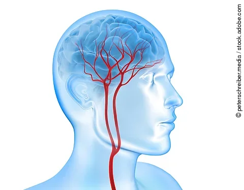 Eine Grafik zeigt die arterielle Blutversorgung im Gehirn. Es ist die Halsschlagader mit abgehenden Gefäßen dargestellt. 