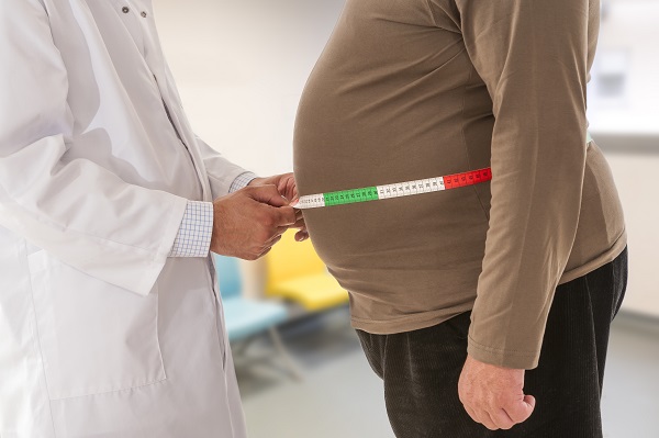 Arzt misst Bauchumfang bei adipösem Patienten.