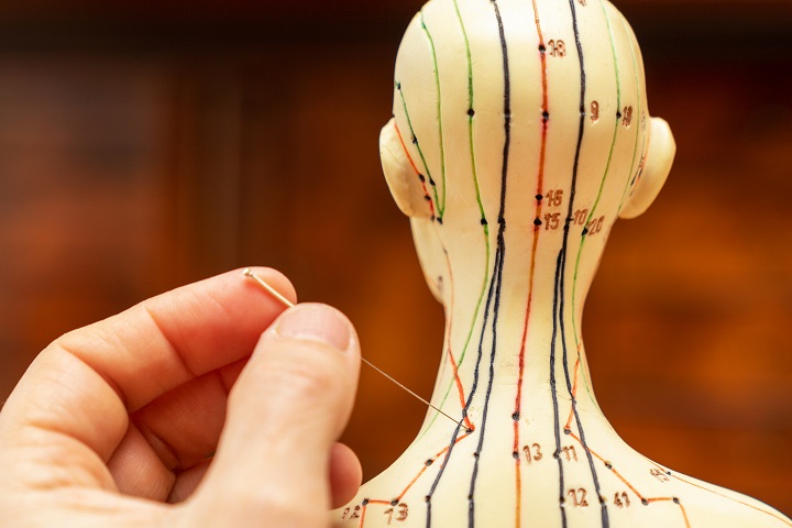 Akupunkturmodell, Meridiane, Akupunkturnadel, Hand