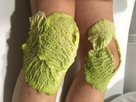 Kohlwickel bei Gonarthrose